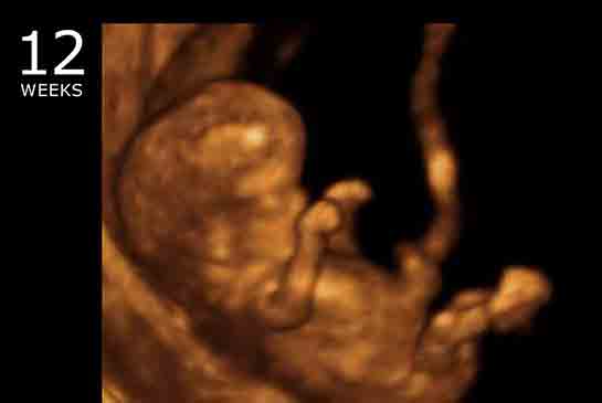 12 Haftalık Gebelikte Annede ve Bebekte Yaşanan Değişimler