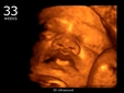 33 Haftalık Gebelik 33 Haftalık Gebelik