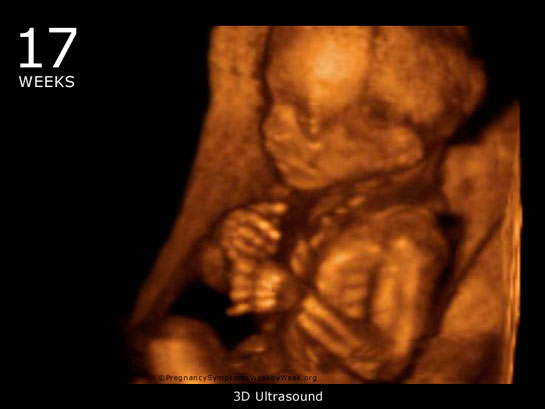 17 Haftalık Gebelik