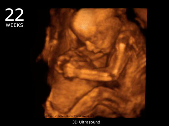 22 Haftalık Gebelik