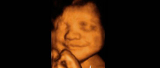 30 Haftalık Gebelik