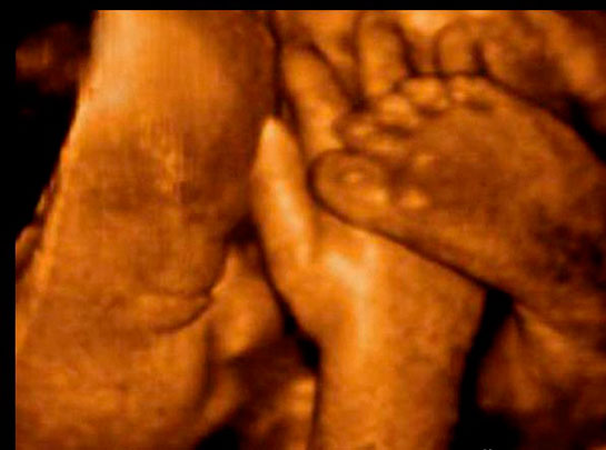 32 Haftalık Gebelik