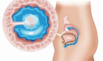 5 Haftalık Gebelikte Annede ve Bebekte Yaşanan Değişimler 5 Haftalık Gebelikte Annede ve Bebekte Yaşanan Değişimler