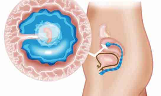 5 Haftalık Gebelikte Annede ve Bebekte Yaşanan Değişimler
